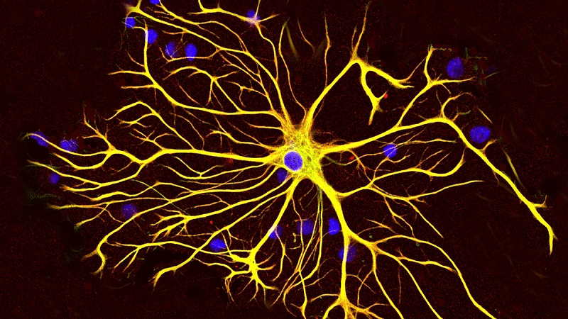 apoptosis3