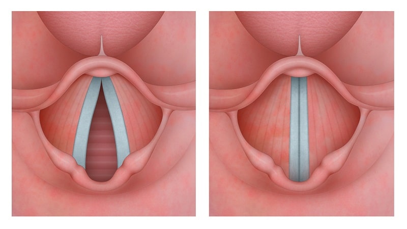 cuerdas vocales