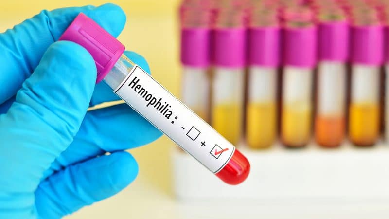 hemofilia2