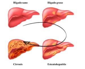 que pasa cuando los tejidos del higado se alteran el laboratorio en peligro